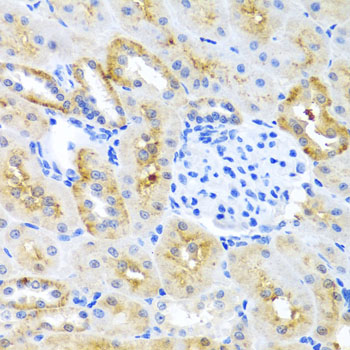 Immunohistochemistry - MOK Polyclonal Antibody 