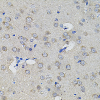 Immunohistochemistry - ACO1 Polyclonal Antibody 