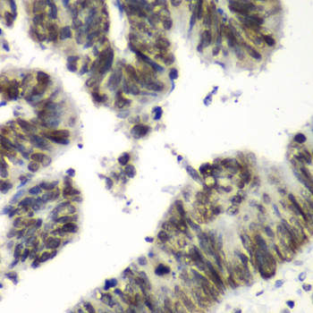 Immunohistochemistry - TEAD1 Polyclonal Antibody 