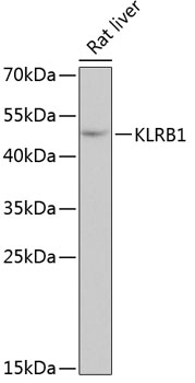 Western blot - KLRB1 Polyclonal Antibody 