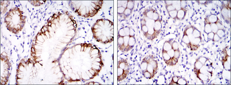 Immunohistochemical analysis of paraffin-embedded stomach tissues (left) and colon tissues (right) using CA9 mouse mAb with DAB staining.