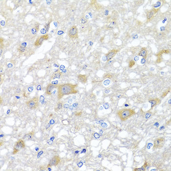 Immunohistochemistry - INPP5K Polyclonal Antibody 