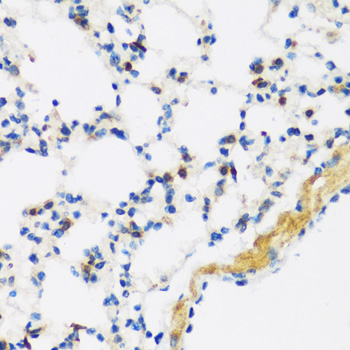 Immunohistochemistry - APOBEC3F Polyclonal Antibody 