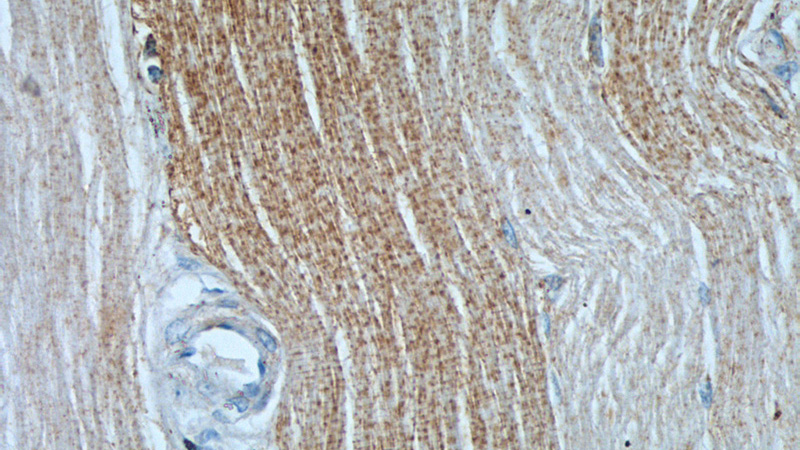 Immunohistochemistry of paraffin-embedded human skeletal muscle tissue slide using Catalog No:110103(DNAJC11 Antibody) at dilution of 1:50 (under 40x lens)