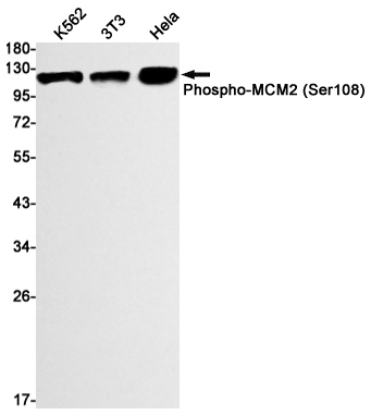 Western blot detection of Phospho-MCM2 (Ser108) in K562,3T3,Hela cell lysates using Phospho-MCM2 (Ser108) Rabbit mAb(1:1000 diluted).Predicted band size:102kDa.Observed band size:125kDa.