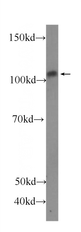 Jurkat cells were subjected to SDS PAGE followed by western blot with Catalog No:107488(SELP Antibody) at dilution of 1:500