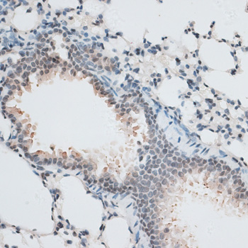Immunohistochemistry - AQR Polyclonal Antibody 