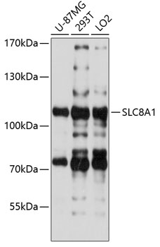 Western blot - SLC8A1 Polyclonal Antibody 