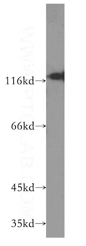 BxPC-3 cells were subjected to SDS PAGE followed by western blot with Catalog No:107042(SDC1,CD138 antibody) at dilution of 1:400
