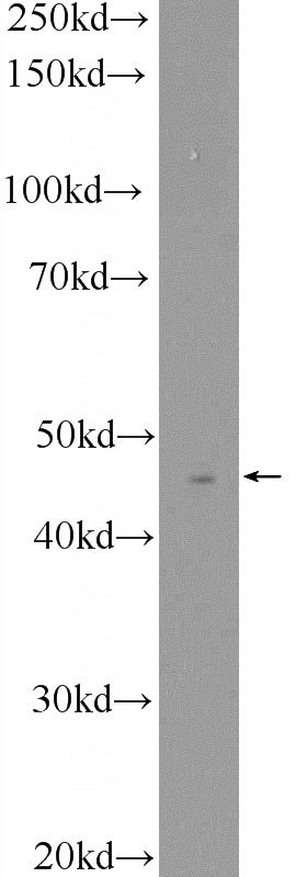 K-562 cells were subjected to SDS PAGE followed by western blot with Catalog No:107995(ACY1 Antibody) at dilution of 1:600
