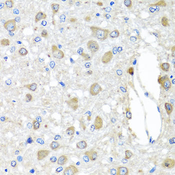 Immunohistochemistry - BAG5 Polyclonal Antibody 
