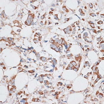 Immunohistochemistry - KIF14 Polyclonal Antibody 
