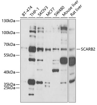 Western blot - SCARB2 Polyclonal Antibody 