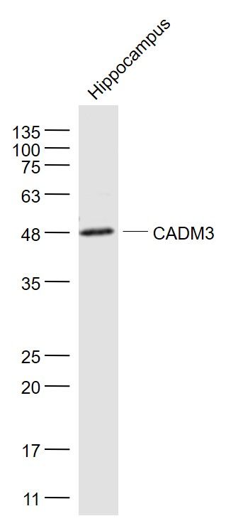 Fig1: Sample:; Hippocampus (Mouse) Lysate at 40 ug; Primary: Anti- CADM3 at 1/1000 dilution; Secondary: IRDye800CW Goat Anti-Rabbit IgG at 1/20000 dilution; Predicted band size: 41 kD; Observed band size: 48 kD