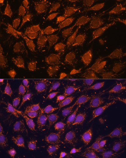 Immunofluorescence - ACAT1 Polyclonal Antibody 