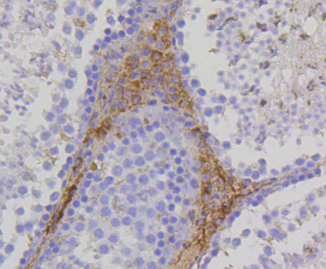 Immunohistochemistry - TSPO Monoclonal Antibody 