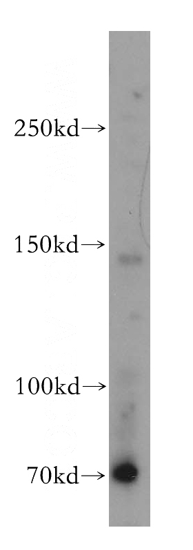 HEK-293 cells were subjected to SDS PAGE followed by western blot with Catalog No:116858(WDR19 antibody) at dilution of 1:600