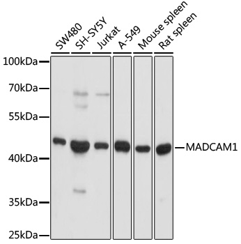 Western blot - MADCAM1 Polyclonal Antibody 