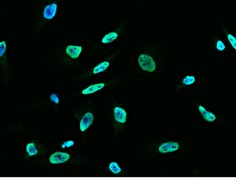 Human TLR6 Immunofluorescence(IF) 15701
