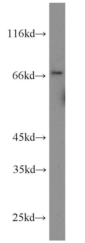 RAW264.7 cells were subjected to SDS PAGE followed by western blot with Catalog No:116623(uPAR, PLAUR antibody) at dilution of 1:500