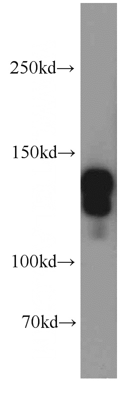 Jurkat cells were subjected to SDS PAGE followed by western blot with Catalog No:115671(STAG2 antibody) at dilution of 1:1000