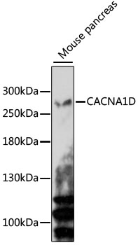 Western blot - CACNA1D Polyclonal Antibody 