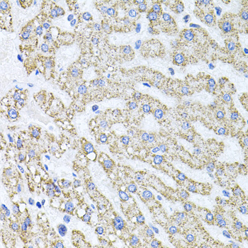 Immunohistochemistry - SDC2 Polyclonal Antibody 