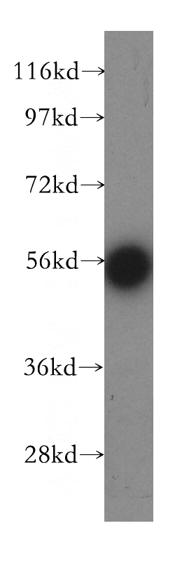 MCF7 cells were subjected to SDS PAGE followed by western blot with Catalog No:110299(EDC3 antibody) at dilution of 1:500