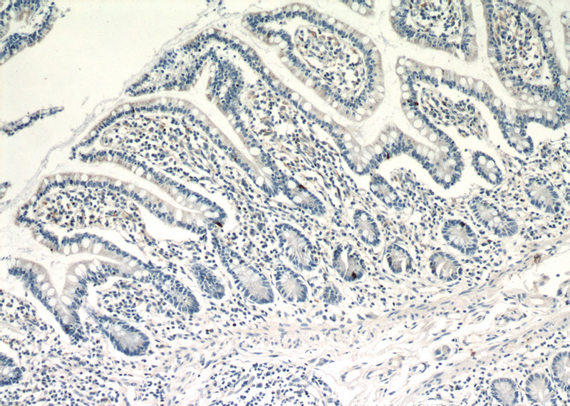 Immunohistochemical of paraffin-embedded human small intestine using Catalog No:112211(LGR5 antibody) at dilution of 1:200 (under 10x lens)