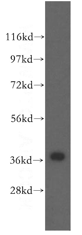 human brain tissue were subjected to SDS PAGE followed by western blot with Catalog No:117055(ZIC4-Specific antibody) at dilution of 1:500