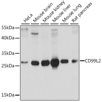 Western blot - CD99L2 Polyclonal Antibody 
