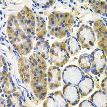 Immunohistochemistry - APBB1 Polyclonal Antibody 