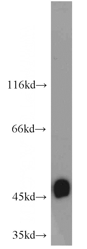 L02 cells were subjected to SDS PAGE followed by western blot with Catalog No:114767(RNH1 antibody) at dilution of 1:2000
