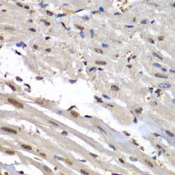 Immunohistochemistry - HNRNPM Polyclonal Antibody 