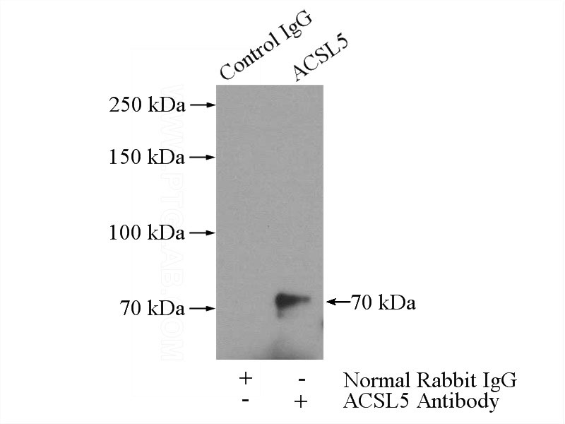 IP Result of anti-ACSL5 (IP:Catalog No:107698, 4ug; Detection:Catalog No:107698 1:600) with mouse brain tissue lysate 4000ug.