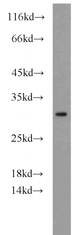 HepG2 cells were subjected to SDS PAGE followed by western blot with Catalog No:114026(PMM2 antibody) at dilution of 1:1000
