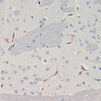 Immunohistochemistry - THBS1 Polyclonal Antibody 