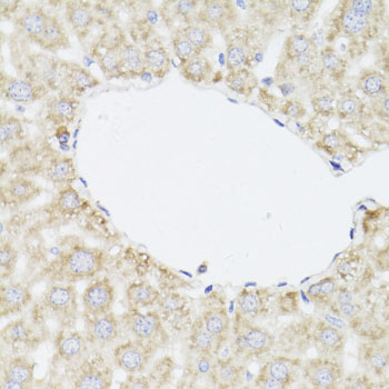 Immunohistochemistry - SAA3 Polyclonal Antibody 