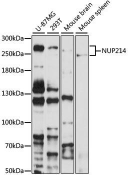 Western blot - NUP214 Polyclonal Antibody 