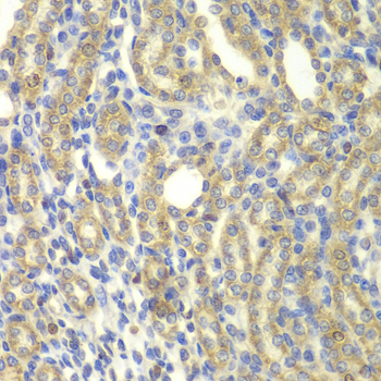 Immunohistochemistry - KBTBD7 Polyclonal Antibody 