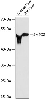 Western blot - SMPD2 Polyclonal Antibody 