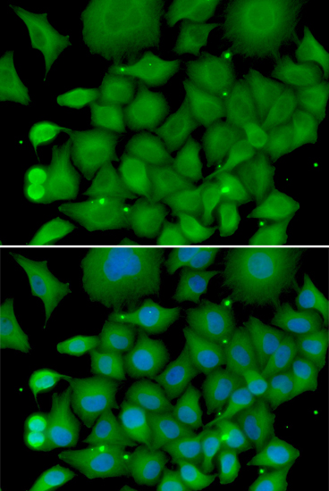 Immunofluorescence - SOD3 Polyclonal Antibody 