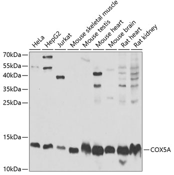 Western blot - COX5A Polyclonal Antibody 