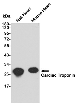 Western blot analysis of extracts from Rat and mouse heart tissue using Troponin I (168340,dilution 1:1000) Mouse mAb.Predicted band size:28kDa.Observed band size:28kDa.