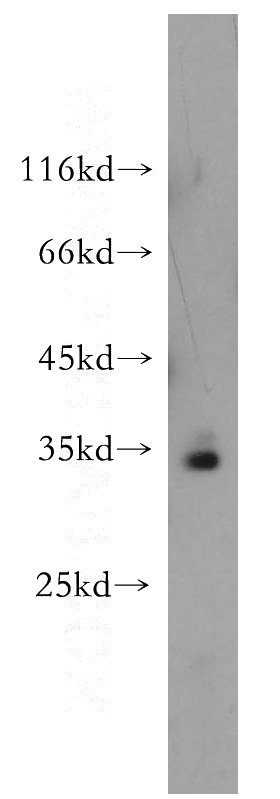 HeLa cells were subjected to SDS PAGE followed by western blot with Catalog No:114118(PPCS antibody) at dilution of 1:500