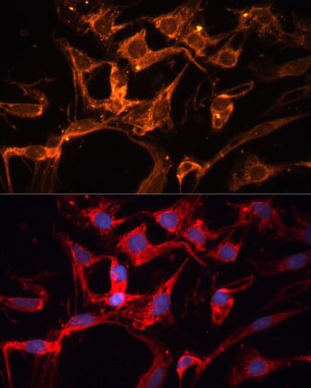 Immunofluorescence - LPL Polyclonal Antibody 