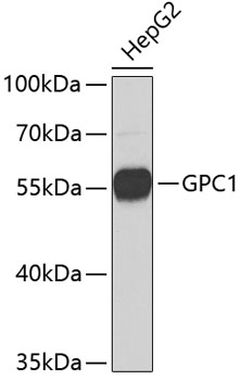 Western blot - GPC1 Polyclonal Antibody 