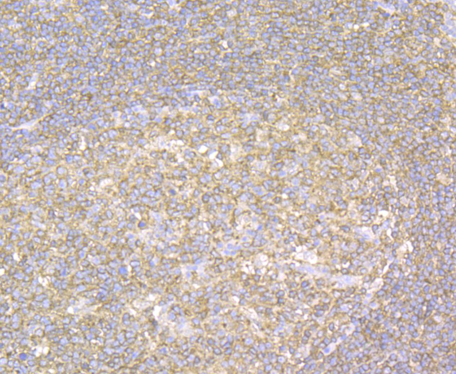 Fig2:; Immunohistochemical analysis of paraffin-embedded human tonsil tissue using anti-YKL-40 / CHI3L1 antibody. The section was pre-treated using heat mediated antigen retrieval with Tris-EDTA buffer (pH 8.0-8.4) for 20 minutes.The tissues were blocked in 5% BSA for 30 minutes at room temperature, washed with ddH; 2; O and PBS, and then probed with the antibody at 1/50 dilution, for 30 minutes at room temperature and detected using an HRP conjugated compact polymer system. DAB was used as the chrogen. Counter stained with hematoxylin and mounted with DPX.