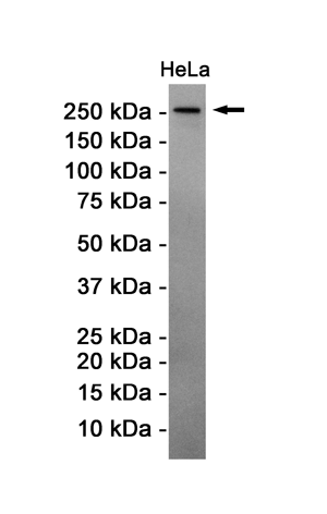 Western blot detection of ATM in Hela cell lysates using ATM Rabbit pAb(1:1000 diluted).Predicted band size:351KDa.Observed band size:351KDa.