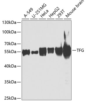Western blot - TFG Polyclonal Antibody 